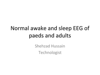 Normal awake and sleep EEG | PPT | Parenting Babies and Toddlers ...