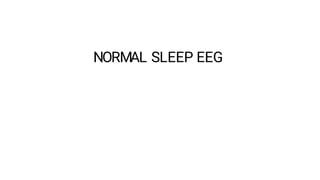 Comprehensive Overview of Normal Awake and Sleep EEG Patterns and Their ...