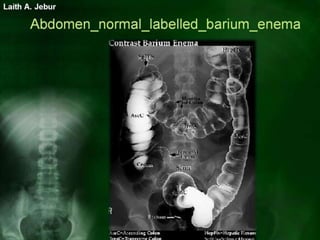 Normal body imaging | PPSX