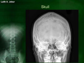 Normal body imaging | PPSX