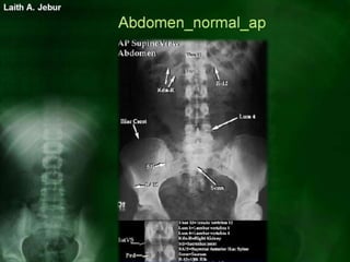 Normal body imaging | PPSX