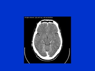 NORMAL BRAIN ANATOMY 2.ppt