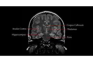 Cardunculus Brain Normal brain & vascualar anatomy human body radiology imaging.pptx
