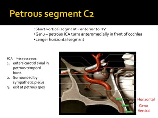 Vertical
•Short vertical segment – anterior to IJV
•Genu – petrous ICA turns anteromedially in front of cochlea
•Longer horizontal segment
ICA –intraosseous
1. enters carotid canal in
petrous temporal
bone.
2. Surrounded by
sympathetic plexus
3. exit at petrous apex
Horizontal
Genu
 