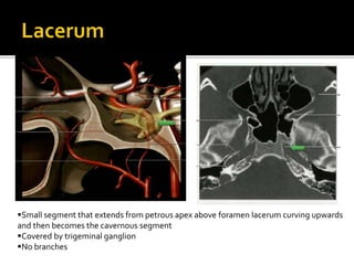 normal-cerebral-angiogram-final-pptx