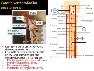  Represent persistent embryonic
circulatory patterns
 Channels between caudal carotid
artery and paired basilar and
vertebral arteries fail to regress.
1. Primitive persistent trigeminal artery
2. Primitive hypoglossal artery
3. Persistent otic artery
4. Proatlantal intersegmental artery
PCoA
PTA
Otic
Hypoglossal
Proatlantal
intersegmental
 