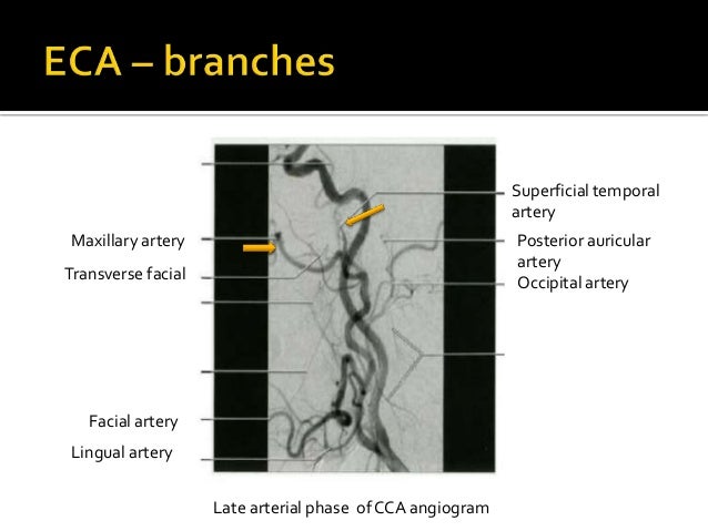 Normal cerebral angiogram final
