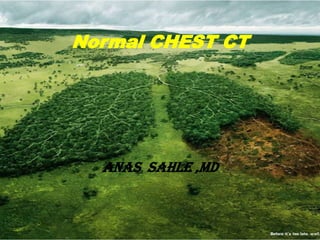 Normal CHEST CT




  ANAS SAHLE ,MD
 