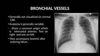 NORMAL CHEST RADIOGRAPGH AND ANATOMY.pptx.pptx