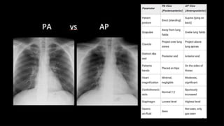 NORMAL CHEST RADIOGRAPGH AND ANATOMY.pptx.pptx