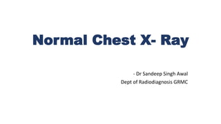 Normal Chest X- Ray
- Dr Sandeep Singh Awal
Dept of Radiodiagnosis GRMC
 