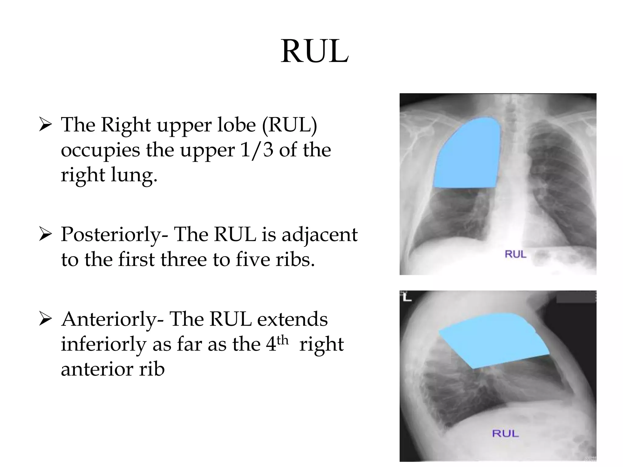 Normal Chest X-Rays & Its Systemic Approach- Anatomy | PPTX