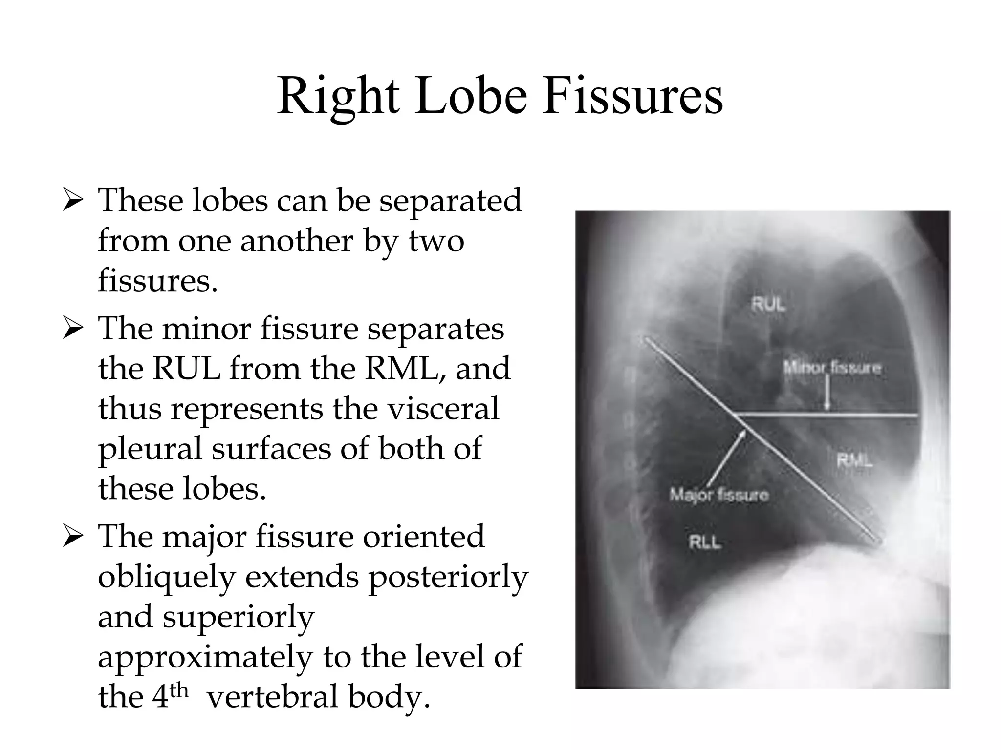 Normal Chest X-Rays & Its Systemic Approach- Anatomy | PPTX
