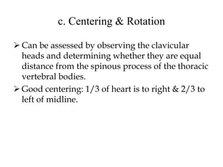 c. Centering & Rotation
 Can be assessed by observing the clavicular
heads and determining whether they are equal
distance from the spinous process of the thoracic
vertebral bodies.
 Good centering: 1/3 of heart is to right & 2/3 to
left of midline.
 