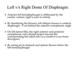 Left v/s Right Dome Of Diaphragm:
 Anterior left hemidiaphragm is obliterated by the
cardiac contact; right is seen in entirity
 By identifying the fissures: left oblique fissure is contacts
diaphragm ~5 cm behind the anterior costophrenic angle
 On left lateral film, the right anterior and posterior
costophrenic sulci should project beyond the
corresponding left sided sulci as a result of x-ray beam
divergence
 By seeing air in stomach and splenic flexure below the
left hemidiaphragm
 