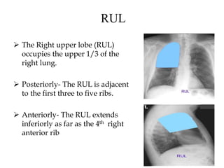 RUL
 The Right upper lobe (RUL)
occupies the upper 1/3 of the
right lung.
 Posteriorly- The RUL is adjacent
to the first three to five ribs.
 Anteriorly- The RUL extends
inferiorly as far as the 4th right
anterior rib
 