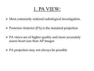 1. PA VIEW:
 Most commonly ordered radiological investigation.
 Posterior-Anterior (PA) is the standard projection
 PA views are of higher quality and more accurately
assess heart size than AP images
 PA projection may not always be possible
 
