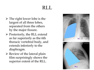 RLL
 The right lower lobe is the
largest of all three lobes,
separated from the others
by the major fissure.
 Posteriorly, the RLL extend
as far superiorly as the 6th
thoracic vertebral body, and
extends inferiorly to the
diaphragm.
 Review of the lateral plain
film surprisingly shows the
superior extent of the RLL.
 