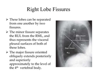 Right Lobe Fissures
 These lobes can be separated
from one another by two
fissures.
 The minor fissure separates
the RUL from the RML, and
thus represents the visceral
pleural surfaces of both of
these lobes.
 The major fissure oriented
obliquely extends posteriorly
and superiorly
approximately to the level of
the 4th vertebral body.
 