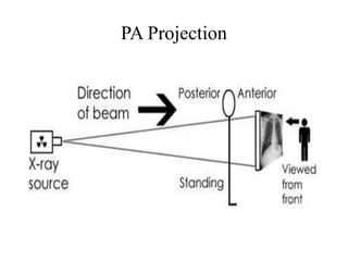 PA Projection
 