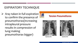  Xray taken in full expiration
to confirm the presence of
pneumothorax(increasing
intrapleural pressure
results in compression of
lung making
pneumothorax bigger)
EXPIRATORY TECHNIQUE
 