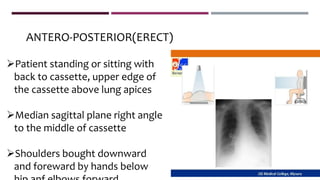 ANTERO-POSTERIOR(ERECT)
Patient standing or sitting with
back to cassette, upper edge of
the cassette above lung apices
Median sagittal plane right angle
to the middle of cassette
Shoulders bought downward
and foreward by hands below
 