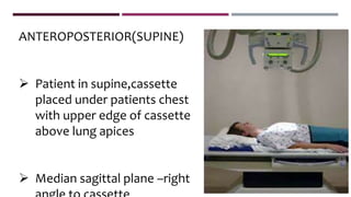 ANTEROPOSTERIOR(SUPINE)
 Patient in supine,cassette
placed under patients chest
with upper edge of cassette
above lung apices
 Median sagittal plane –right
 