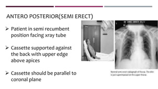 ANTERO POSTERIOR(SEMI ERECT)
 Patient in semi recumbent
position facing xray tube
 Cassette supported against
the back with upper edge
above apices
 Cassette should be parallel to
coronal plane
 
