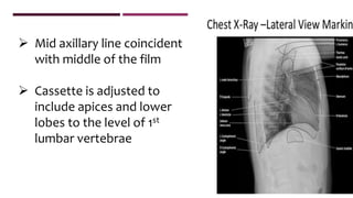  Mid axillary line coincident
with middle of the film
 Cassette is adjusted to
include apices and lower
lobes to the level of 1st
lumbar vertebrae
 