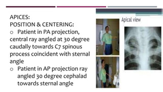 APICES:
POSITION & CENTERING:
o Patient in PA projection,
central ray angled at 30 degree
caudally towards C7 spinous
process coincident with sternal
angle
o Patient in AP projection ray
angled 30 degree cephalad
towards sternal angle
 
