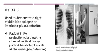LORDOTIC
Used to demonstrate right
middle lobe collapse or
interlobar pleural effusion
 Patient in PA
projection,clasping the
sides of vertical bucky
patient bends backwards
at the waist(30-40 degree)
 