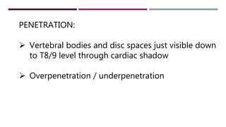 PENETRATION:
 Vertebral bodies and disc spaces just visible down
to T8/9 level through cardiac shadow
 Overpenetration / underpenetration
 