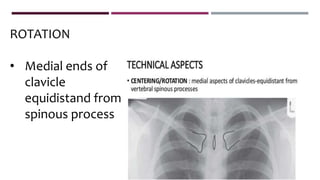 ROTATION
• Medial ends of
clavicle
equidistand from
spinous process
 