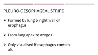  Formed by lung & right wall of
esophagus
 From lung apex to azygos
 Only visualised if esophagus contain
air.
PLEURO-OESOPHAGEAL STRIPE
 
