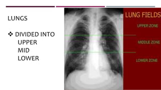 LUNGS
 DIVIDED INTO
UPPER
MID
LOWER
 
