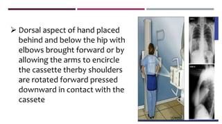  Dorsal aspect of hand placed
behind and below the hip with
elbows brought forward or by
allowing the arms to encircle
the cassette therby shoulders
are rotated forward pressed
downward in contact with the
cassete
 