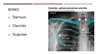 BONES
o Sternum
o Clavicles
o Scapulae
 