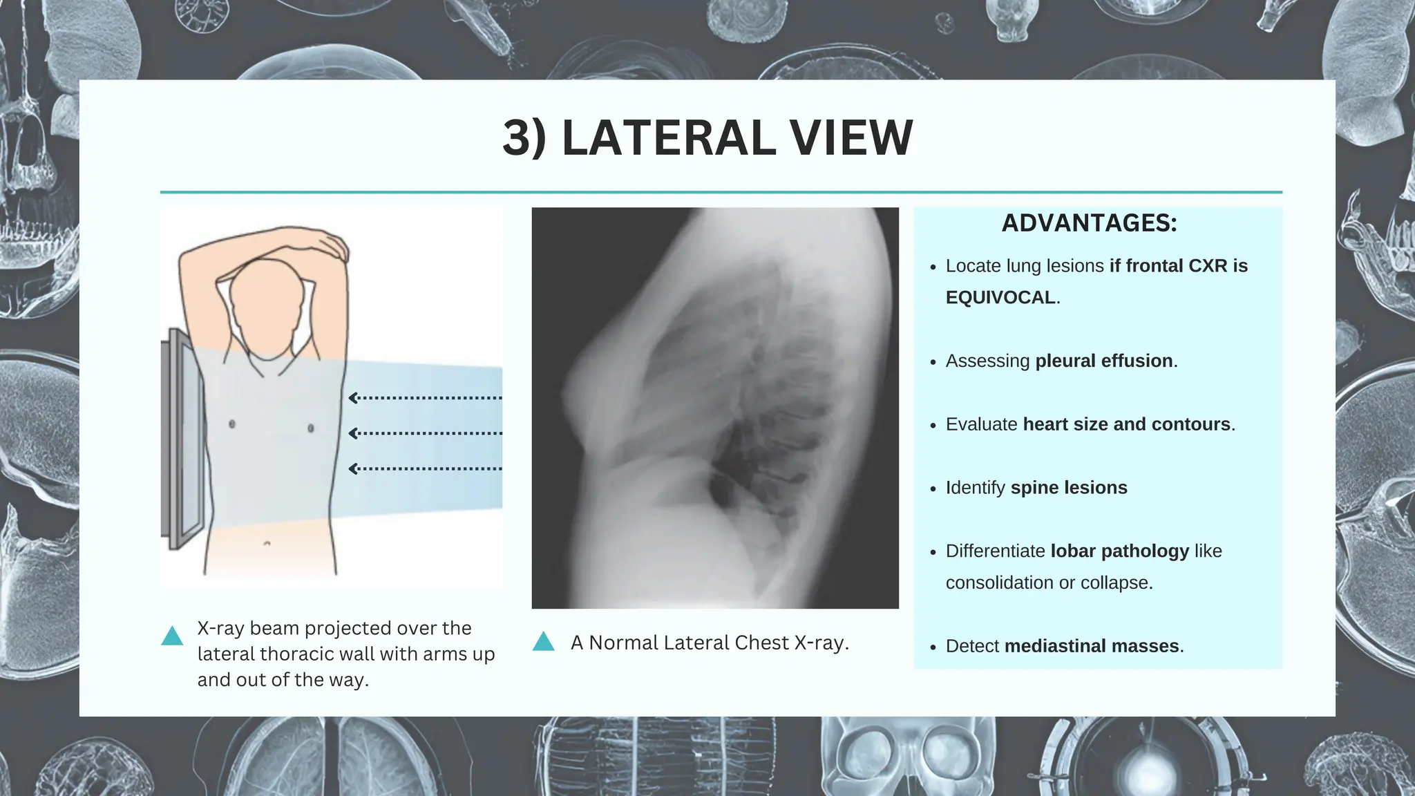 Normal chest Xray: Fundamentals and Basic Interpretation (By Dr ...