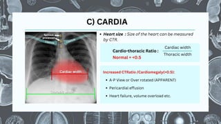 Normal chest Xray: Fundamentals and Basic Interpretation (By Dr ...