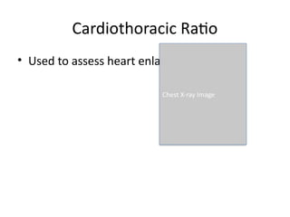 Comprehensive Guide to Normal Chest X-ray Anatomy: Lungs, Heart ...