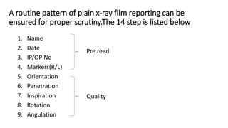 3rd Digit X Ray Routine Normal chest x ray and collapse | PPTX