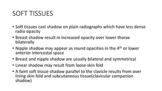 Normal chest x ray and collapse | PPTX