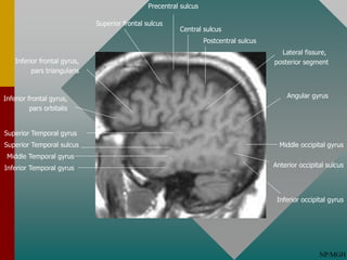Normal Cortical Anatomy.pptx