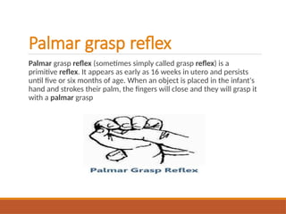 Palmar grasp reflex
Palmar grasp reflex (sometimes simply called grasp reflex) is a
primitive reflex. It appears as early as 16 weeks in utero and persists
until five or six months of age. When an object is placed in the infant's
hand and strokes their palm, the fingers will close and they will grasp it
with a palmar grasp
 