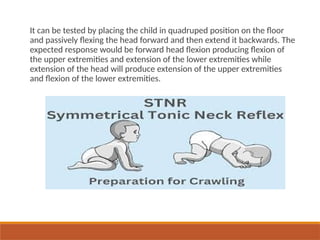 It can be tested by placing the child in quadruped position on the floor
and passively flexing the head forward and then extend it backwards. The
expected response would be forward head flexion producing flexion of
the upper extremities and extension of the lower extremities while
extension of the head will produce extension of the upper extremities
and flexion of the lower extremities.
 