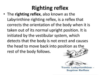 Righting Reflex R Normal Development Milestones. Padriatic Lecture 4 | PDF