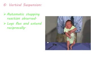 6. Vertical Suspension: 
 Automatic stepping 
reaction observed. 
 Legs flex and extend 
reciprocally. 
 