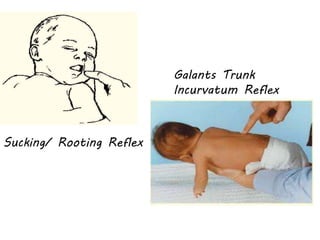 Sucking/ Rooting Reflex 
Galants Trunk 
Incurvatum Reflex 
 