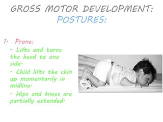 GROSS MOTOR DEVELOPMENT: 
1. Prone: 
POSTURES: 
- Lifts and turns 
the head to one 
side. 
- Child lifts the chin 
up momentarily in 
midline. 
- Hips and knees are 
partially extended. 
 