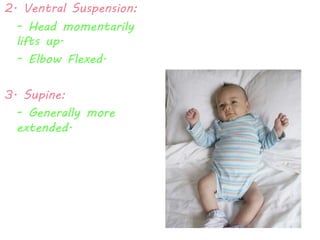 2. Ventral Suspension: 
- Head momentarily 
lifts up. 
- Elbow Flexed. 
3. Supine: 
- Generally more 
extended. 
 